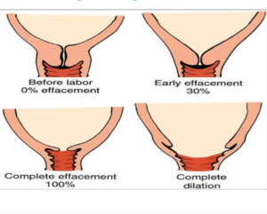 How your cervix changes during labour