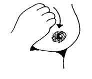 Antenatal hand expression  - diagram showing how to gently roll closed fist over the breast towards the nipple