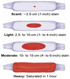 Diagram showing postnatal bleeding amounts after giving birth