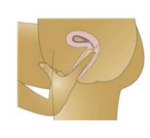 A diagram showing how to check the threads on your IUD