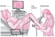 Colposcopy examination sketch