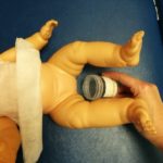 Collecting a urine sample from an infant - figure 3