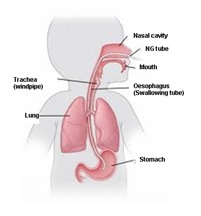 Tube feeding diagram