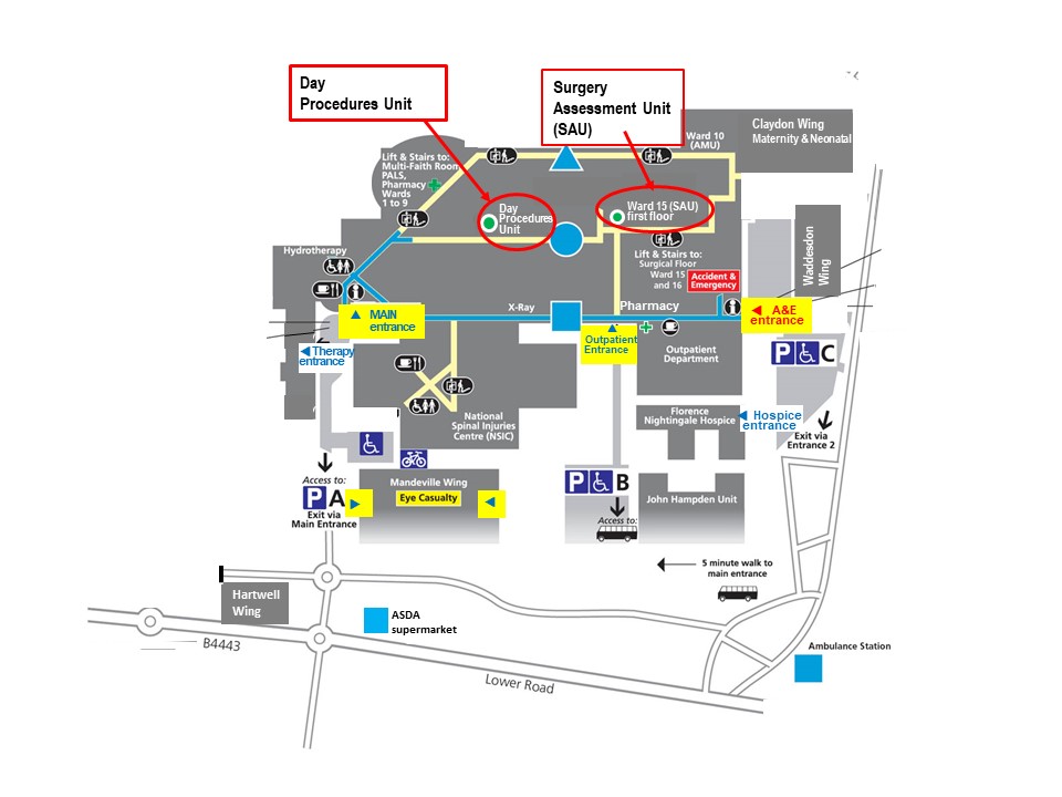 Map of Stoke Mandeville Hospital indicating the location of the Day Surgery Unit and Surgery Assessment Unit