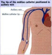 Image Showing position of the MIDLINE