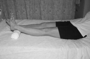 Knee arthroscopy exercises towel rolled underneath ankle