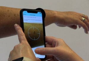 Skin Analytics AI system_taking pic w iphone